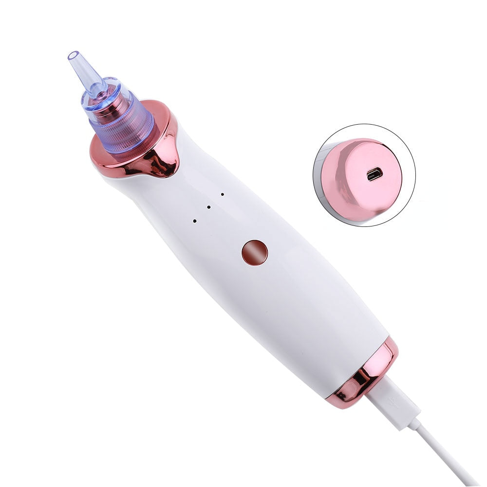 Electric Acne and Blackhead Remover Device AANHORA-SHOPPING